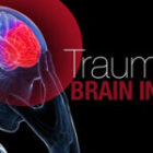 Traumatic Brain Injury after a Truck Accident